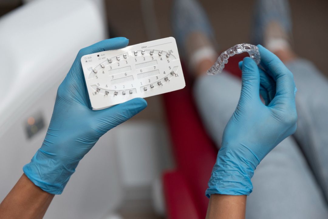 how long until you see results from clear aligners a timeline guide 